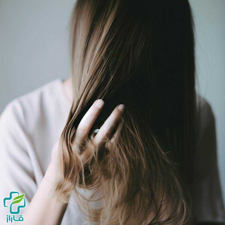 ریزش مو و راهکار های مقابله با آن